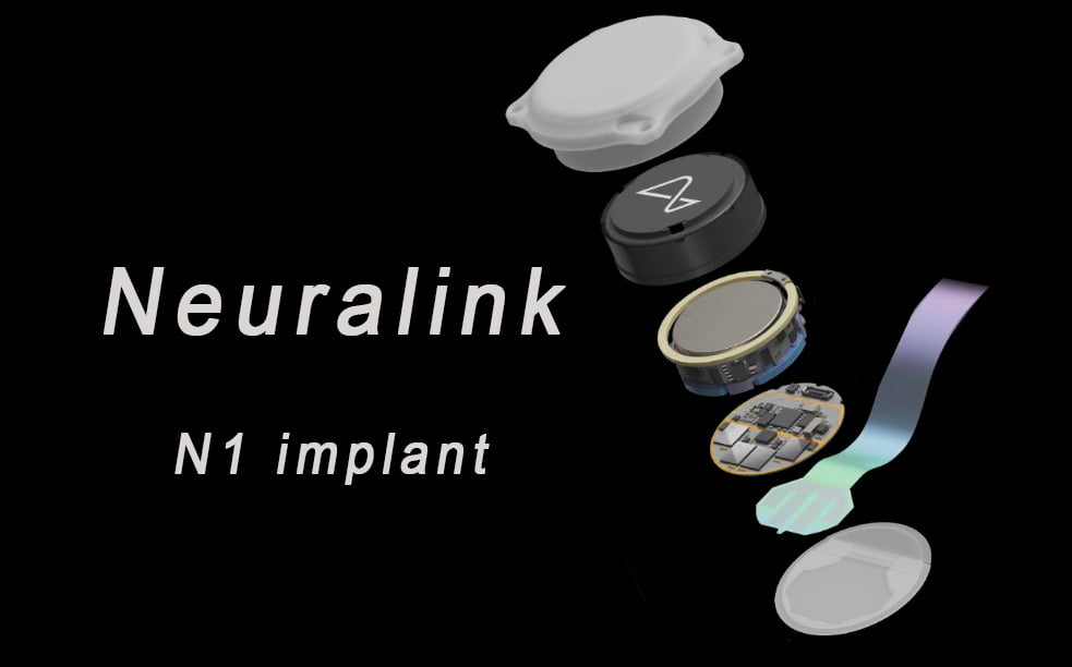 Neuralink N1 implant