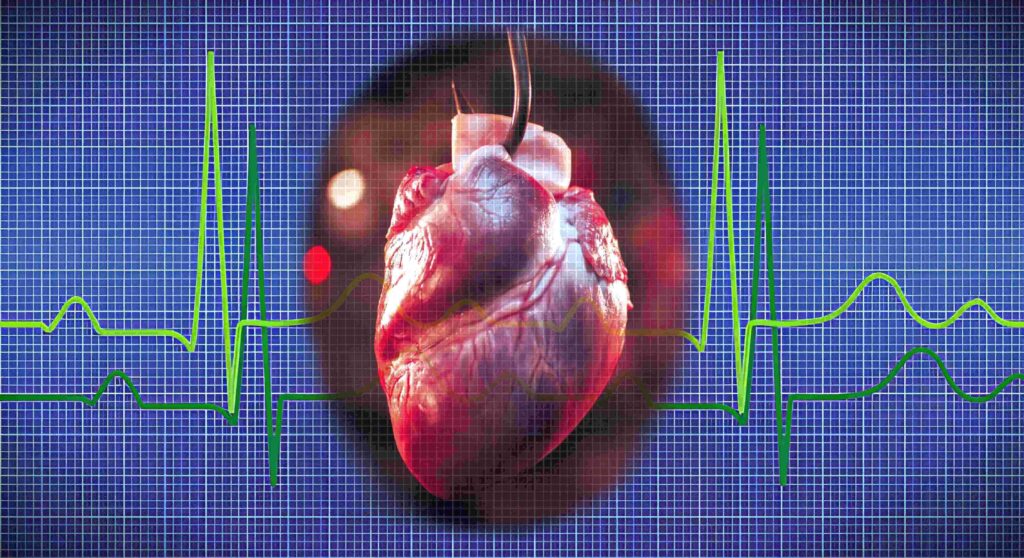 Ventricular Fibrillation: Impact of AC & DC Current Shocks on Heart