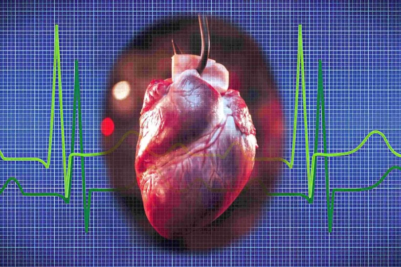 Ventricular Fibrillation: Impact of AC & DC Current Shocks on Heart